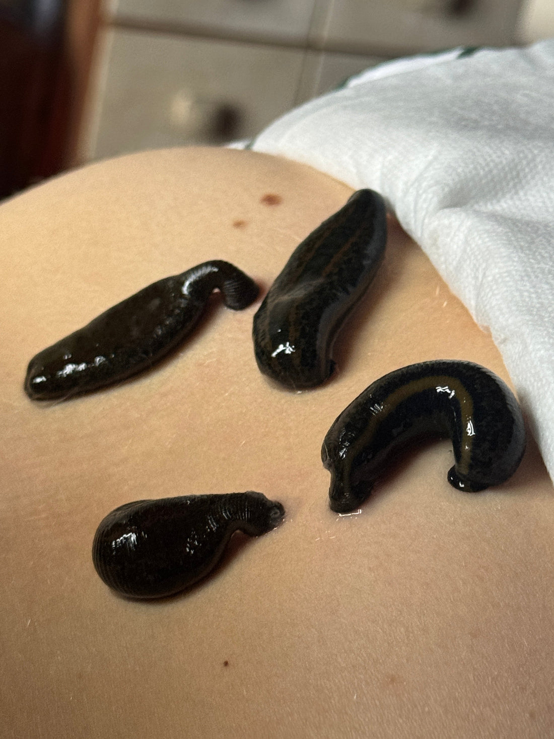 Hirudoterapiaa terveydeksi!